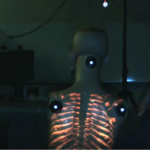 Il futuro della realtà aumentata in medicina: projectdr